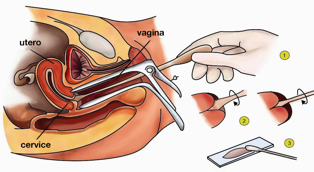 Obstetrică Și Ginecologie - Vol 2 Gin (Stamatian) Papilloma virus e ciclo mestruale