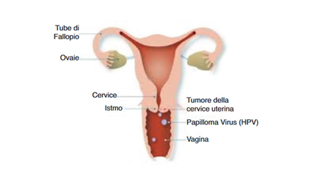 Anatomia - Tumore della cervice uterina - Centro HPV - Casa di Cura Villa Mafalda Roma